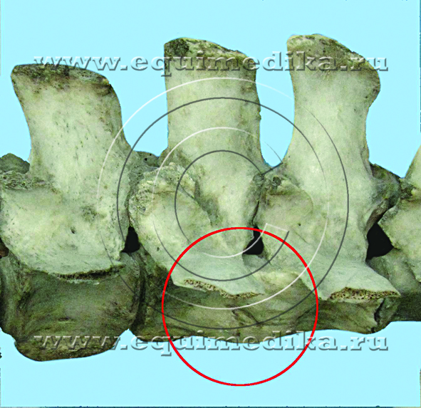 Рис 2. Спондилезы тел поясничных позвонков_copy.jpg